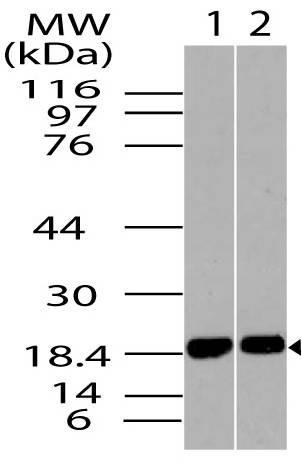 Polyclonal Antibody to ACP1 isoform B