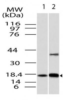 Polyclonal Antibody to ACP1