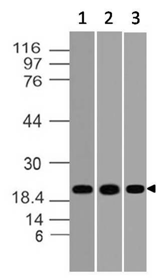 Polyclonal Antibody to DUSP18