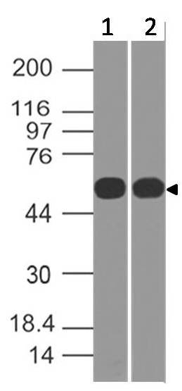 Polyclonal Antibody to TRK Fused gene