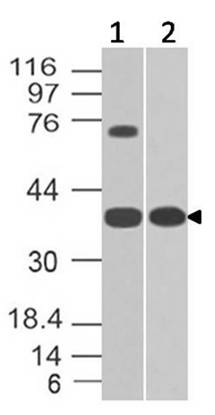 Polyclonal Antibody to GPR18