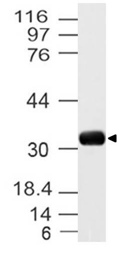 Polyclonal Antibody to UCP3