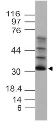 Polyclonal Antibody to UCP4