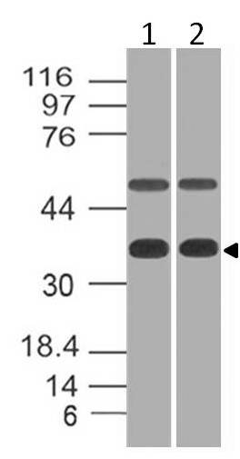 Polyclonal Antibody to eIF3G