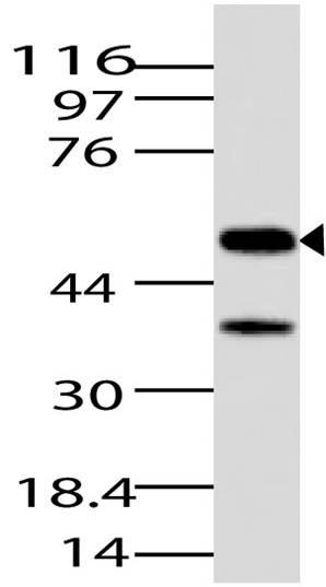 Polyclonal Antibody to JMJD5