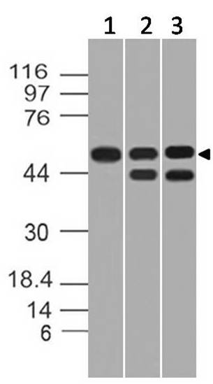 Polyclonal Antibody to TIP60