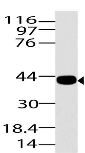 Polyclonal Antibody to ASAP3