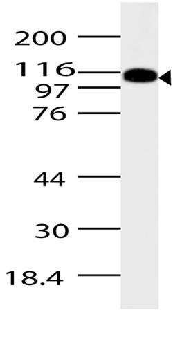 Polyclonal Antibody to ASAP2