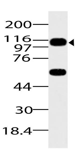 Polyclonal Antibody to ASAP1