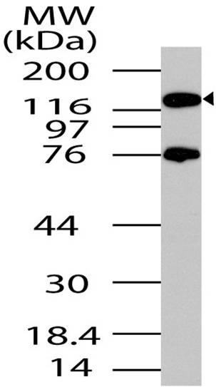 Polyclonal Antibody to PER2