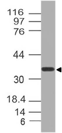 Polyclonal Antibody to NUP35