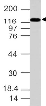 Polyclonal Antibody to AP3 Delta