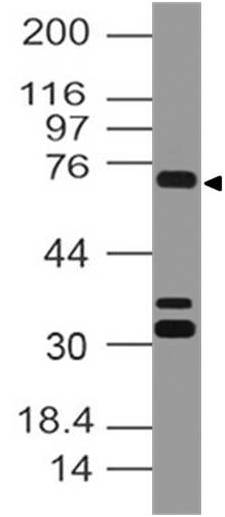 Polyclonal Antibody to  SENP1