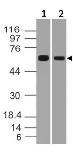 Polyclonal Antibody to h RGS11