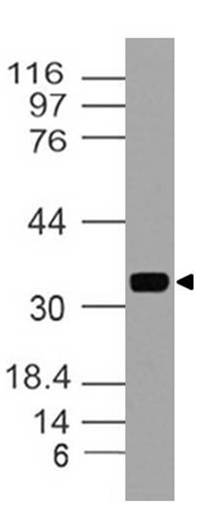 Polyclonal Antibody to  MYADM