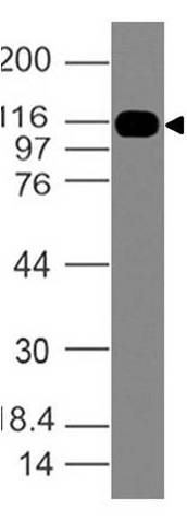 Polyclonal Antibody to SMO