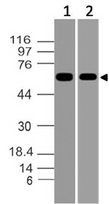 Polyclonal Antibody to Asb-2