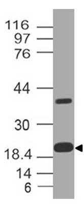 Polyclonal Antibody to Ferritin Light Chain