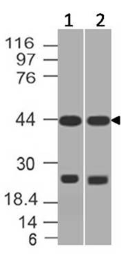 Polyclonal Antibody to AP3M1