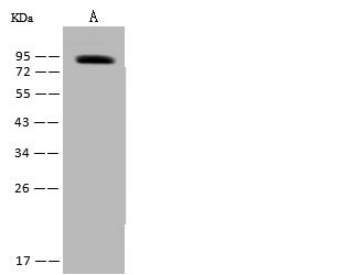 Polyclonal Antibody to PLOD1