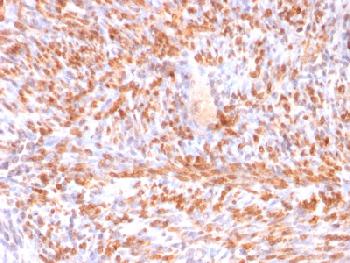 Recombinant Mouse Monoclonal Antibody to Calponin-1 (Smooth Muscle Marker)(Clone : rCNN1/832)