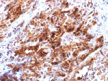 Recombinant Mouse Monoclonal Antibody to Glypican-3 (GPC3) (Hepatocellular Carcinoma Marker)(Clone : rGPC3/863)