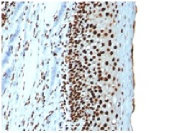 Recombinant Mouse Monoclonal Antibody to Histone H1 (Nuclear Marker)(Clone : r1415-1)