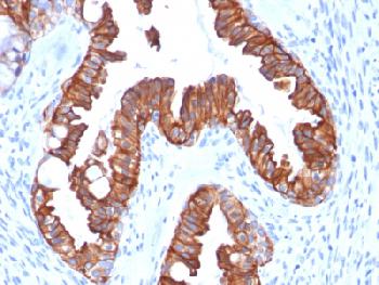 Recombinant Mouse Monoclonal Antibody to Cytokeratin 7 (Glandular and Transitional Epithelial Marker)(Clone : rOV-TL12/30)