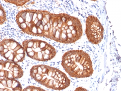 Recombinant Mouse Monoclonal Antibody to Ep-CAM / CD326 (Epithelial Marker)(Clone : rVU-1D9)