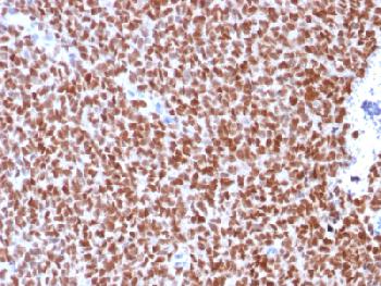 Recombinant Mouse Monoclonal Antibody to NKX2.2 (Neuroendocrine & Ewing's Sarcoma Marker)(Clone : rNX2/294)