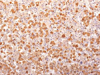 Recombinant Mouse Monoclonal Antibody to ACTH (Adrenocorticotrophic Hormone) (N-Terminal) (Pituitary Marker)(Clone : r57)