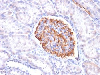 Recombinant Mouse Monoclonal Antibody to Wilm's Tumor 1 (WT1) (Wilm's Tumor & Mesothelial Marker)(Clone : rWT1/857)