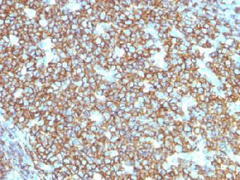 Recombinant Mouse Monoclonal Antibody to CD20 / MS4A1 (B-Cell Marker)(Clone : rIGEL/773)