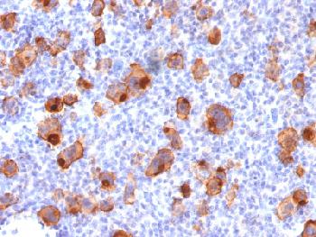 Recombinant Mouse Monoclonal Antibody to CD30 / TNFRSF8 (Hodgkin & Reed-Sternberg Cell Marker)(Clone : rKi-1/779)