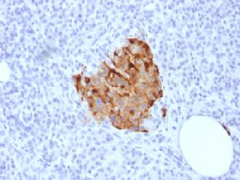 Recombinant Rabbit Monoclonal Antibody to Chromogranin A / CHGA (Neuroendocrine Marker)(Clone : CHGA/1773R)