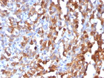 Recombinant Rabbit Monoclonal Antibody to MART-1 / Melan-A / MLANA (Melanoma Marker)(Clone : MLANA/1409R)