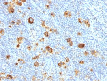 Recombinant Rabbit Monoclonal Antibody to CD15 / FUT4 (Reed-Sternberg Cell Marker)(Clone : FUT4/1478R)