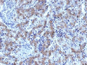 Recombinant Rabbit Monoclonal Antibody to Glypican-3 (GPC3) (Hepatocellular Carcinoma Marker)(Clone : GPC3/1534R)