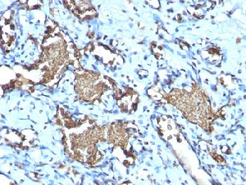 Recombinant Rabbit Monoclonal Antibody to Glycophorin A / CD235a (Erythrocyte Marker)(Clone : GYPA/1725R)