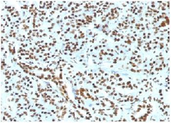 Recombinant Rabbit Monoclonal Antibody to Histone H1 (Nuclear Marker)(Clone : HH1/1784R)