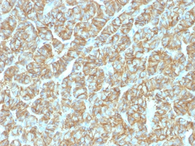 Recombinant Rabbit Monoclonal Antibody to Ep-CAM / CD326 (Epithelial Marker)(Clone : EGP40/1555R)