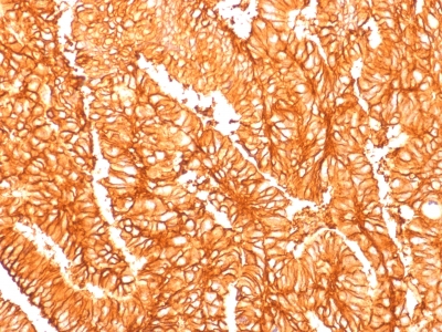 Recombinant Rabbit Monoclonal Antibody to Ep-CAM / CD326 (Epithelial Marker)(Clone : EGP40/1556R)