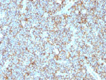 Recombinant Rabbit Monoclonal Antibody to CD99 / MIC2 (Ewing s Sarcoma Marker)(Clone : MIC2/1495R)