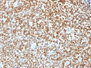 Recombinant Rabbit Monoclonal Antibody to NKX2.2 (Neuroendocrine & Ewing s Sarcoma Marker)(Clone : NX2/1422R)