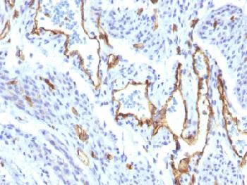 Recombinant Rabbit Monoclonal Antibody to CD31 / PECAM-1 (Endothelial Cell Marker)(Clone : C31/1395R)