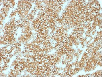 Recombinant Rabbit Monoclonal Antibody to Parathyroid Hormone (PTH) (N-Terminal)(Clone : PTH/1717R)