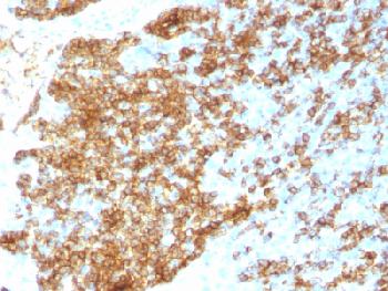 Recombinant Rabbit Monoclonal Antibody to CD45RB (B-Cell Marker)(Clone : PTPRC/1783R)