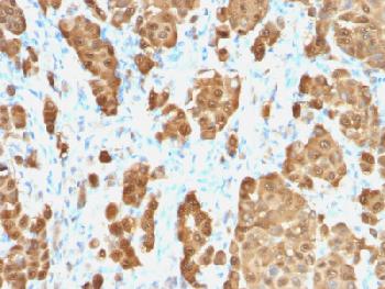 Recombinant Rabbit Monoclonal Antibody to S100B (Astrocyte and Melanoma Marker)(Clone : S100B/1706R)