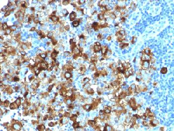 Recombinant Rabbit Monoclonal Antibody to gp100 / Melanosome / PMEL17 / SILV (Melanoma Marker)(Clone : PMEL/1825R)