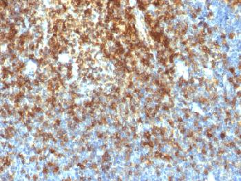 Recombinant Rabbit Monoclonal Antibody to CD43 (T-Cell Marker)(Clone : SPN/1766R)